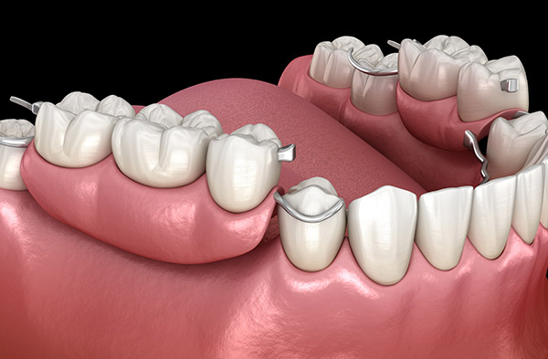 What is Prosthodontics dentistry