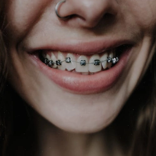 Orthodontic Treatment banner